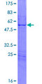 HOXA7 Protein - 12.5% SDS-PAGE of human HOXA7 stained with Coomassie Blue