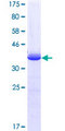 HOXC10 Protein - 12.5% SDS-PAGE Stained with Coomassie Blue.