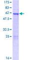 HOXD4 Protein - 12.5% SDS-PAGE of human HOXD4 stained with Coomassie Blue