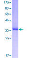 HOXD8 Protein - 12.5% SDS-PAGE Stained with Coomassie Blue.