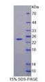 HPCAL4 Protein - Recombinant Hippocalcin Like Protein 4 (HPCAL4) by SDS-PAGE