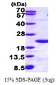 HR6B / UBE2B Protein