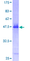 HRAS / H-Ras Protein - 12.5% SDS-PAGE of human HRAS stained with Coomassie Blue