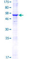 HRASLS5 Protein - 12.5% SDS-PAGE of human HRASLS5 stained with Coomassie Blue