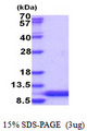 HSBP1L1 Protein
