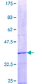 HSCB Protein - 12.5% SDS-PAGE Stained with Coomassie Blue.