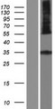 HSD11B1L Protein - Western validation with an anti-DDK antibody * L: Control HEK293 lysate R: Over-expression lysate