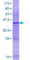 HSD11B1L Protein - 12.5% SDS-PAGE of human SCDR10 stained with Coomassie Blue