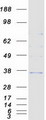HSD17B6 Protein - Purified recombinant protein HSD17B6 was analyzed by SDS-PAGE gel and Coomassie Blue Staining