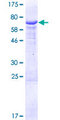 HSDL2 Protein - 12.5% SDS-PAGE of human HSDL2 stained with Coomassie Blue