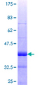 HSFY1 Protein - 12.5% SDS-PAGE Stained with Coomassie Blue.