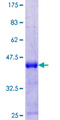 HSFY2 Protein - 12.5% SDS-PAGE Stained with Coomassie Blue.