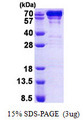 HSPA5 / GRP78 / BiP Protein