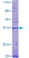 HSPC004 / POP5 Protein - 12.5% SDS-PAGE of human POP5 stained with Coomassie Blue