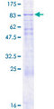 HSPC167 / CDK5RAP1 Protein - 12.5% SDS-PAGE of human CDK5RAP1 stained with Coomassie Blue