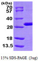 HsT19268 / MTHFS Protein