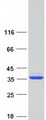 HT036 / HYI Protein - Purified recombinant protein HYI was analyzed by SDS-PAGE gel and Coomassie Blue Staining
