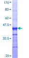 HTTY1 / TTYH1 Protein - 12.5% SDS-PAGE Stained with Coomassie Blue.