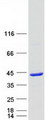 HTYW5 / C2orf60 Protein - Purified recombinant protein TYW5 was analyzed by SDS-PAGE gel and Coomassie Blue Staining