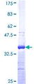 HZF16 / ZNF124 Protein - 12.5% SDS-PAGE Stained with Coomassie Blue.