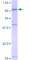IEF-SSP-9502 / PWP1 Protein - 12.5% SDS-PAGE of human PWP1 stained with Coomassie Blue