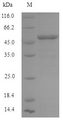 IFIH1 / MDA5 Protein - (Tris-Glycine gel) Discontinuous SDS-PAGE (reduced) with 5% enrichment gel and 15% separation gel.