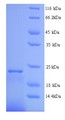 IFNA2 / Interferon Alpha 2 Protein