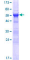 IFT46 Protein - 12.5% SDS-PAGE of human C11orf60 stained with Coomassie Blue
