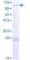 IFT81 Protein - 12.5% SDS-PAGE of human IFT81 stained with Coomassie Blue