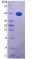 IGF1 Protein - Recombinant  Insulin Like Growth Factor 1 By SDS-PAGE