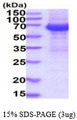 IL12RB1 / CD212 Protein
