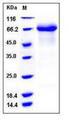IL12RB1 / CD212 Protein