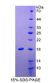 IL24 Protein - Recombinant Interleukin 24 By SDS-PAGE