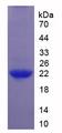 IL37 Protein - Recombinant Interleukin 1 Zeta By SDS-PAGE