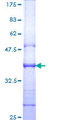 IL6ST / CD130 / gp130 Protein - 12.5% SDS-PAGE Stained with Coomassie Blue.