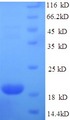 ILDR2 Protein