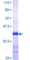 ILKAP Protein - 12.5% SDS-PAGE Stained with Coomassie Blue.