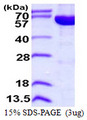 IMPDH2 Protein