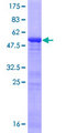 ING5 Protein - 12.5% SDS-PAGE of human ING5 stained with Coomassie Blue
