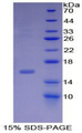 INHBB / Inhibin Beta B Protein - Recombinant Inhibin Beta B By SDS-PAGE