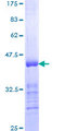 INPPL1 / SHIP2 Protein - 12.5% SDS-PAGE Stained with Coomassie Blue.