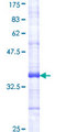 INSR / Insulin Receptor Protein - 12.5% SDS-PAGE Stained with Coomassie Blue.