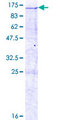 INT7 / INTS7 Protein - 12.5% SDS-PAGE of human INTS7 stained with Coomassie Blue