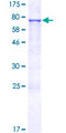 IOP1 / NARFL Protein - 12.5% SDS-PAGE of human NARFL stained with Coomassie Blue