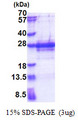 IPP2 / PPP1R2 Protein