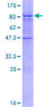 IPPK Protein - 12.5% SDS-PAGE of human IPPK stained with Coomassie Blue
