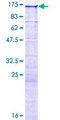 IQCH Protein - 12.5% SDS-PAGE of human IQCH stained with Coomassie Blue