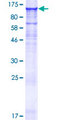 IQUB Protein - 12.5% SDS-PAGE of human IQUB stained with Coomassie Blue