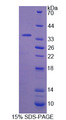 IRS2 / IRS-2 Protein - Recombinant Insulin Receptor Substrate 2 By SDS-PAGE