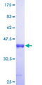 ISCA1 Protein - 12.5% SDS-PAGE of human HBLD2 stained with Coomassie Blue